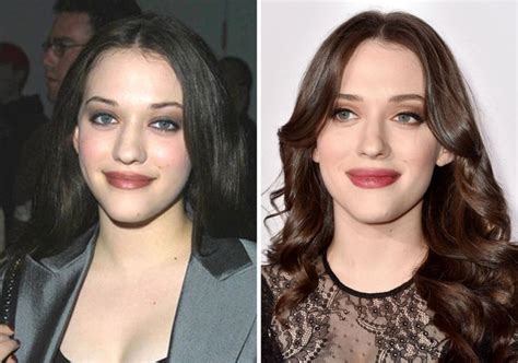 kat dennings breast|Kat Dennings Plastic Surgery Photos [Before & After]